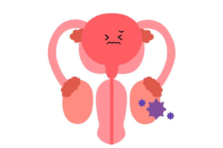 精巣・陰嚢疾患のイメージ画像